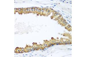 Immunohistochemistry of paraffin-embedded human prostate using LLGL2 antibody.