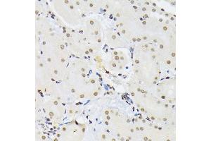 Immunohistochemistry of paraffin-embedded mouse kidney using PTBP1 antibody  at dilution of 1:100 (40x lens). (PTBP1 anticorps  (AA 1-290))