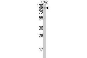 Western blot analysis of ACE2 polyclonal antibody  in K-562 cell lysate (35 ug/lane).