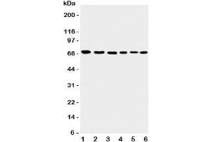 Western blot testing of Apoptosis-Inducing Factor antibody and Lane 1:  rat heart;  2: (r) brain;  3: human K562;  4: (h) HEPG2;  5: (h) A431;  6: mouse NIH3T3 cell lysate.