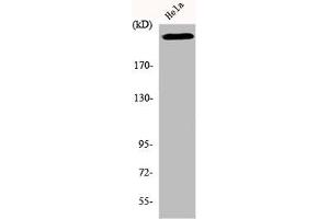Western Blot analysis of HeLa cells using DNA-PKCS Polyclonal Antibody (PRKDC anticorps  (C-Term))