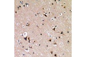 Immunohistochemical analysis of p53 (pS376) staining in human brain formalin fixed paraffin embedded tissue section. (p53 anticorps  (C-Term, pSer376))
