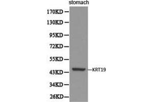 Western Blotting (WB) image for anti-Keratin 19 (KRT19) antibody (ABIN1873481) (Cytokeratin 19 anticorps)