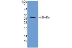 Detection of Recombinant iPLA2, Human using Polyclonal Antibody to Phospholipase A2, Calcium Independent (iPLA2) (PNPLA2 anticorps  (AA 484-701))
