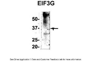 IP Suggested Anti-EIF3G Antibody Positive Control: NT2 CELL/BRAIN TISSUE (EIF3G anticorps  (Middle Region))