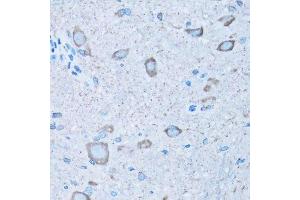 Immunohistochemistry of paraffin-embedded mouse spinal cord using NNMT antibody.