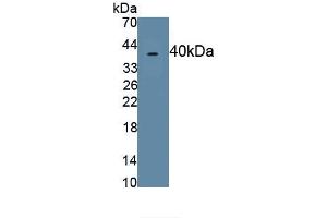 Detection of Recombinant MIP4a, Human using Polyclonal Antibody to Macrophage Inflammatory Protein 4 Alpha (MIP4a) (CCL26 anticorps  (AA 24-94))