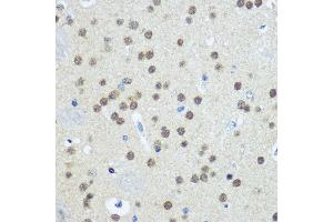 Immunohistochemistry of paraffin-embedded Mouse brain using UB antibody (2359) at dilution of 1:100 (40x lens). (UBA1 anticorps  (AA 300-600))