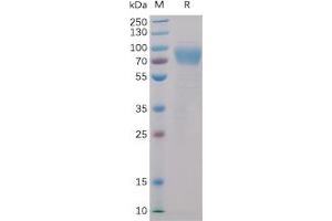 Human 2B4, mFc-His Tag on SDS-PAGE under reducing condition. (2B4 Protein (mFc-His Tag))