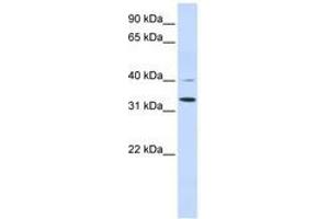 Image no. 1 for anti-Crystallin, zeta (CRYZ) (AA 216-265) antibody (ABIN6740951)