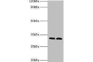 Western blot All lanes: RDM1 antibody at 4 μg/mL Lane 1: PC-3 whole cell lysate Lane 2: MCF-7 whole cell lysate Secondary Goat polyclonal to rabbit IgG at 1/10000 dilution Predicted band size: 32, 30, 16, 14, 29, 26, 9, 13, 19, 27 kDa Observed band size: 32 kDa