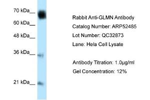 WB Suggested Anti-GLMN Antibody Titration: 0. (GLMN anticorps  (C-Term))