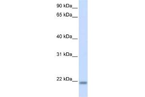 WB Suggested Anti-CNBP Antibody Titration:  0. (CNBP anticorps  (N-Term))