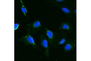 IF analysis of IFT88 using anti-IFT88 antibody (ABIN7600458).