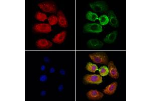 ABIN6264773 and ABIN6278630 staining Hela cells by IF/ICC. (URI1 anticorps  (Internal Region))