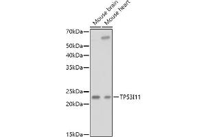 Western blot analysis of extracts of various cell lines, using TP53I11 antibody (ABIN6131365, ABIN6149418, ABIN6149419 and ABIN6216636) at 1:1000 dilution. (TP53I11 anticorps  (AA 1-70))