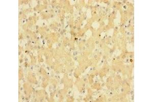 Immunohistochemistry of paraffin-embedded human liver tissue using ABIN7143148 at dilution of 1:100