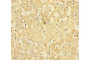 Immunohistochemistry of paraffin-embedded human liver tissue using ABIN7143148 at dilution of 1:100 (SUB1 anticorps  (AA 2-127))