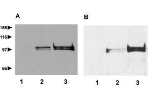 Western blot analysis of repetin expression in cytosolic (lane 1), membrane (lane 2) and cytoskeletal (lane 3) extracts from suspension-induced human keratinocytes (A) and human foreskin biopsy (B) using anti-Repetin, pAb (AF646) . (Repetin anticorps  (AA 570-584))