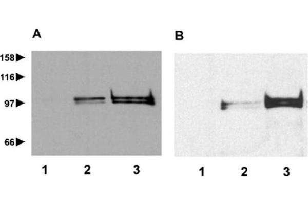 Repetin anticorps  (AA 570-584)