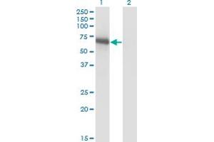 Western Blot analysis of BIN1 expression in transfected 293T cell line by BIN1 monoclonal antibody (M01), clone 1H1. (BIN1 anticorps  (AA 355-454))