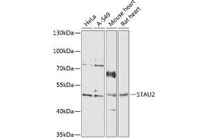 Western blot analysis of extracts of various cell lines, using ST antibody  at 1:1000 dilution. (Double-stranded RNA-binding protein Staufen homolog 2 (STAU2) (AA 300-400) anticorps)
