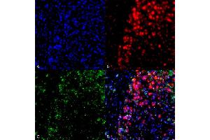 Immunocytochemistry/Immunofluorescence analysis using Mouse Anti-Alpha Synuclein Monoclonal Antibody, Clone 3F8 (ABIN5564091).