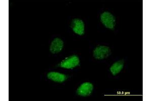Immunofluorescence of purified MaxPab antibody to HDAC9 on HeLa cell. (HDAC9 anticorps  (AA 1-1069))