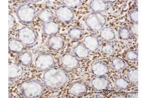 Immunoperoxidase of monoclonal antibody to HCLS1 on formalin-fixed paraffin-embedded human colon. (HCLS1 anticorps  (AA 266-355))