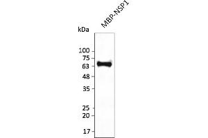 Western Blotting (WB) image for anti-SARS-CoV-2 Host Translation Inhibitor Nsp1 (NSP1) antibody (ABIN7272996) (SARS-CoV-2 NSP1 anticorps)