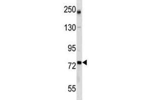 GCLC antibody western blot analysis in mouse bladder tissue lysate (GCLC anticorps  (AA 286-315))