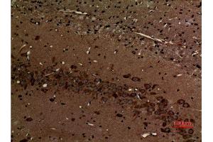 Immunohistochemistry (IHC) analysis of paraffin-embedded Rat Brain, antibody was diluted at 1:100.
