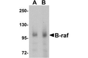 Western blot analysis of B-raf in human brain tissue lysate with B-raf antibody at (A) 1 and (B) 2 μg/ml. (BRAF anticorps  (Center))