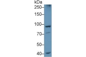 Detection of PSMD2 in Rat Cerebrum lysate using Polyclonal Antibody to Proteasome 26S Subunit, Non ATPase 2 (PSMD2) (PSMD2 anticorps  (AA 645-872))