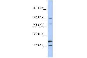 WFDC5 antibody used at 1 ug/ml to detect target protein. (WFDC5 anticorps  (N-Term))
