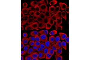 Confocal immunofluorescence analysis of Hela cells using SQSTM1/p62 Polyclonal Antibody (ABIN6128552, ABIN6148419, ABIN6148425 and ABIN6223705) at dilution of 1:200.
