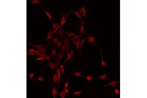 ABIN6272269 staining HeLa by IF/ICC. (CTNNA2 anticorps  (C-Term))
