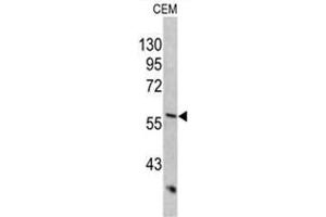 Western blot analysis of KRT10 antibody (Center) in CEM cell line lysates (35ug/lane). (Keratin 10 anticorps  (Middle Region))