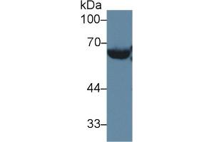 Detection of LCAT in Mouse Serum using Polyclonal Antibody to Lecithin Cholesterol Acyltransferase (LCAT) (LCAT anticorps  (AA 290-432))