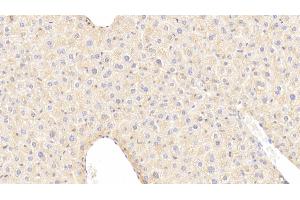 Detection of IGFBP4 in Mouse Liver Tissue using Polyclonal Antibody to Insulin Like Growth Factor Binding Protein 4 (IGFBP4) (IGFBP4 anticorps  (AA 22-254))