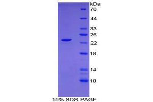SDS-PAGE (SDS) image for C-Type Lectin Domain Family 10, Member A (CLEC10A) (AA 71-239) protein (His tag) (ABIN1879587)