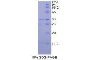 SDS-PAGE (SDS) image for Carbonic Anhydrase II (CA2) (AA 1-260) protein (His tag) (ABIN1879348) (CA2 Protein (AA 1-260) (His tag))