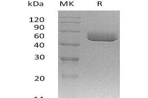 Western Blotting (WB) image for Serine (Or Cysteine) Peptidase Inhibitor, Clade A, Member 1C (SERPINA1C) protein (His tag) (ABIN7320685)