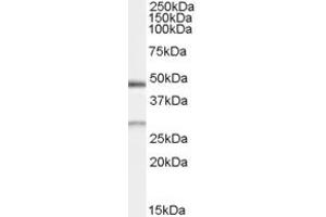 Western Blotting (WB) image for anti-BCL2/adenovirus E1B 19kDa Interacting Protein 1 (BNIP1) (AA 162-176) antibody (ABIN295942) (BNIP1 anticorps  (AA 162-176))