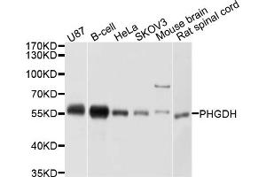 Western blot analysis of extracts of various cell lines, using PHGDH antibody (ABIN5998506) at 1/1000 dilution. (PHGDH anticorps)