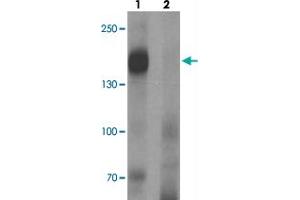 Western blot analysis of LNPEP in human lung tissue with LNPEP polyclonal antibody  at 1 ug/mL in (1) the absence and (2) the presence of blocking peptide. (LNPEP anticorps  (C-Term))