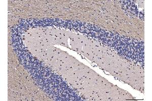 IHC analysis of FGF2 using anti-FGF2 antibody (ABIN7603215). (FGF2 anticorps  (N-Term))
