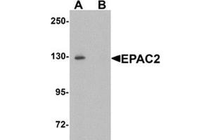 Western blot analysis of EPAC2 in rat liver tissue lysate with EPAC2 Antibody at 1 μg/ml in (A) the absence and (B) the presence of blocking peptide. (RAPGEF4 anticorps  (N-Term))
