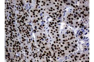 Image no. 2 for anti-Zinc Finger and SCAN Domain Containing 18 (ZSCAN18) antibody (ABIN1501861) (ZSCAN18 anticorps)