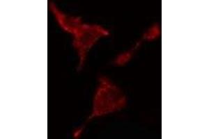ABIN6278562 staining  HeLa cells by IF/ICC. (CTBP2 anticorps  (C-Term))